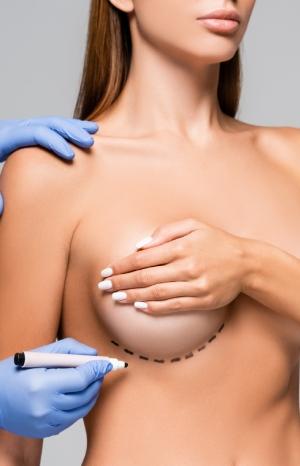Top Breast Surgery in lucknow
