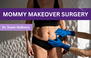 Mommy Makeover - Rhinoplasty
