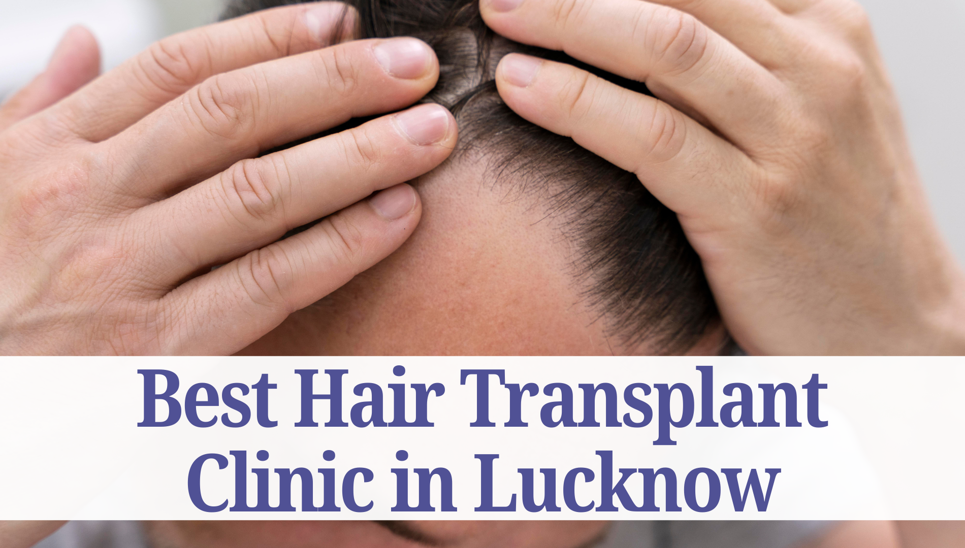 Hair Transplantation clinic in Lucknow