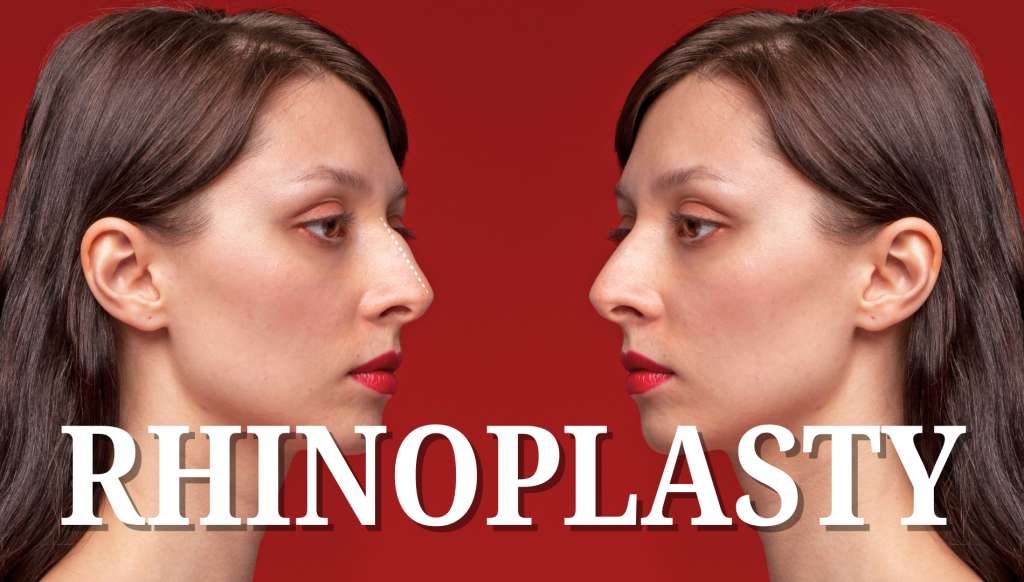 Rhinoplasty Surgery in Lucknow