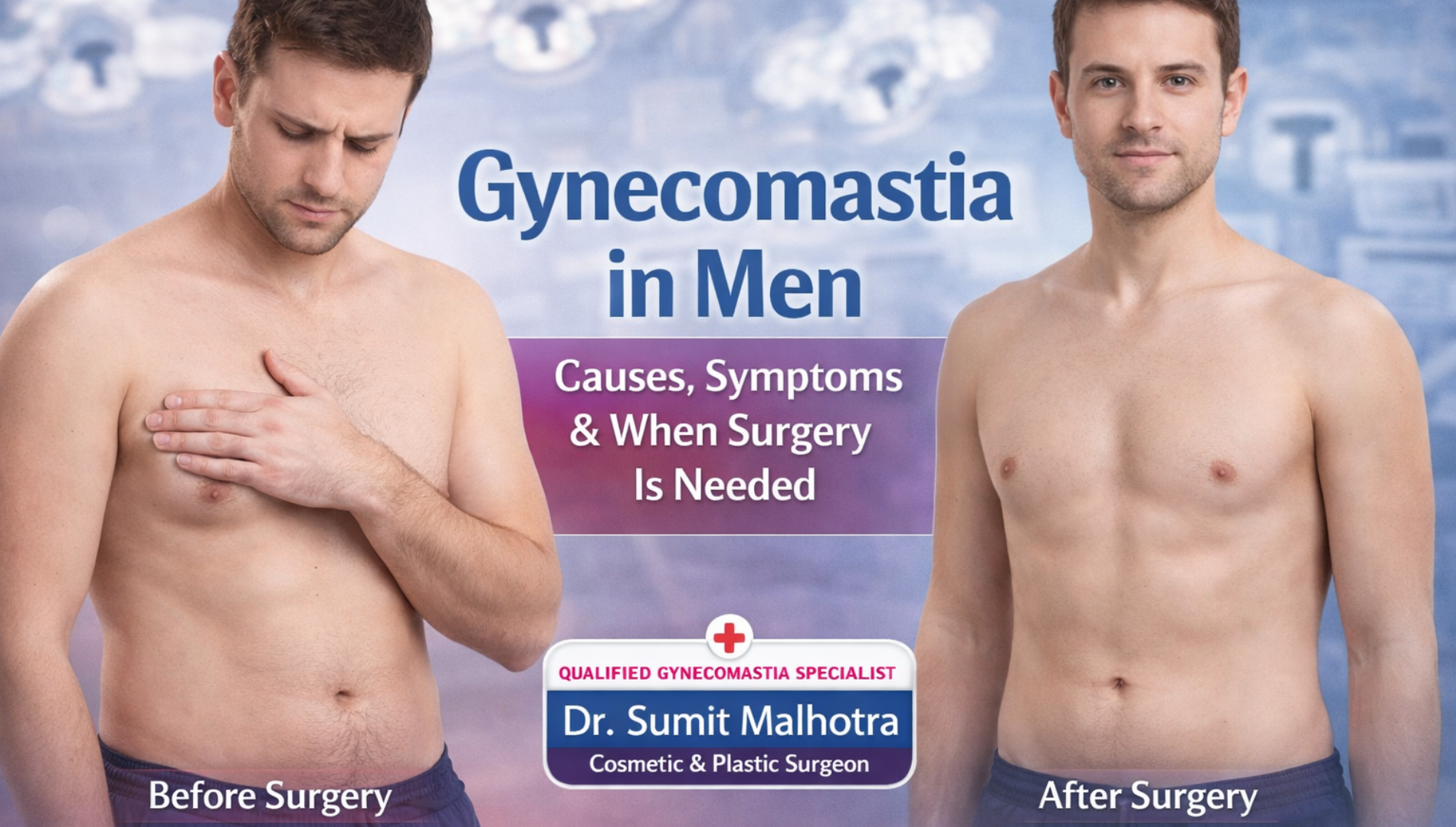 Gynecomastia in Men: Causes, Symptoms & When Surgery Is Needed